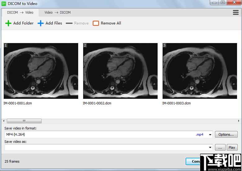 DICOM to Video下载,DICOM转视频