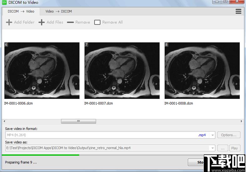 DICOM to Video下载,DICOM转视频