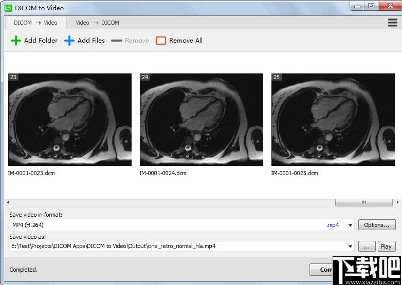 DICOM to Video下载,DICOM转视频
