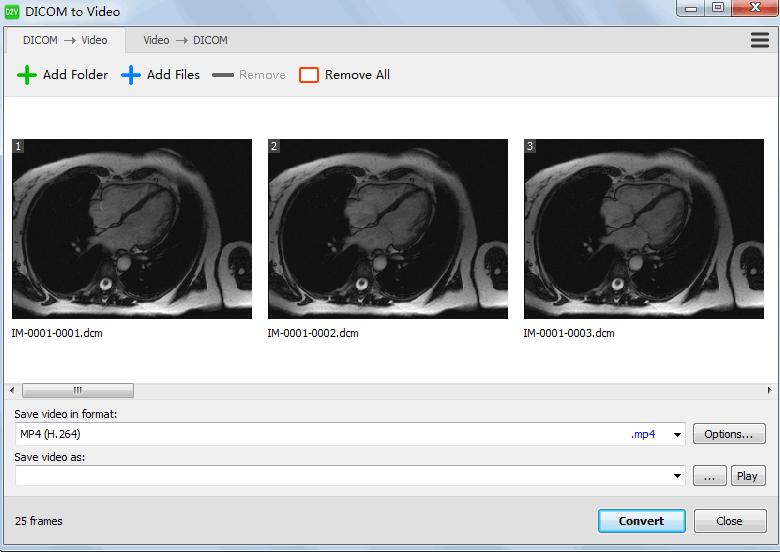 DICOM to Video下载,DICOM转视频